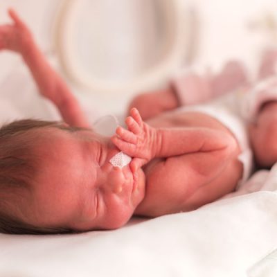 KCKZ bijscholing-premature baby